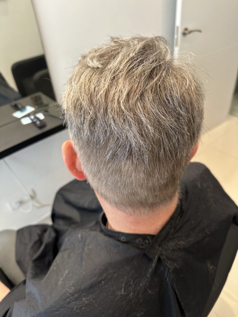 Men's Hair Systems example 3