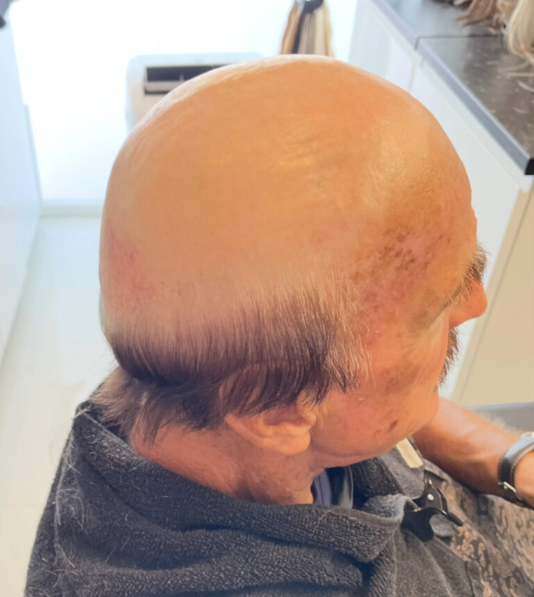 Men's Hair Systems example 5