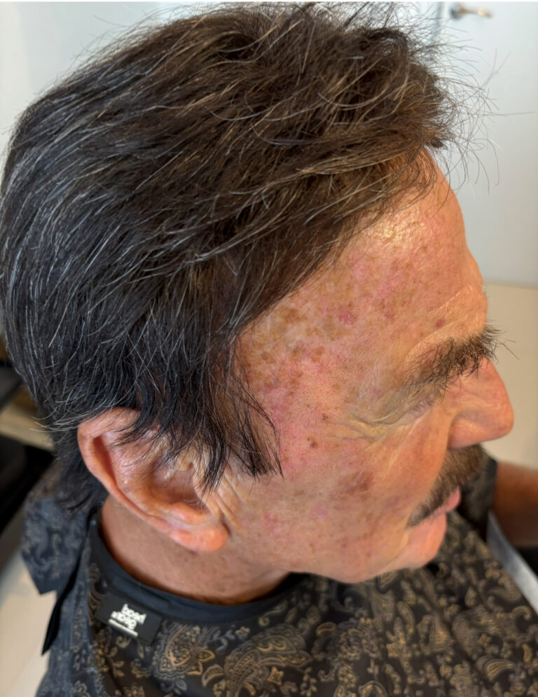 Men's Hair Systems example 6